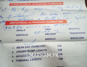 Pregnancy Concieve Problem