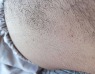 Dermatologist For Skin Issues