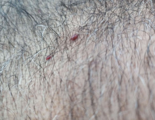 Dermatologist For Skin Issues