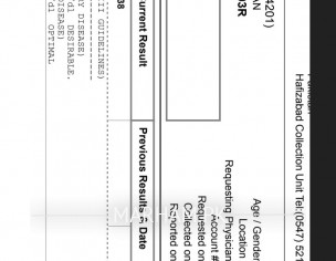 Serum Cholesterol