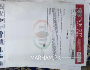 MND(Motor Neuron Disease)