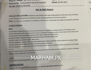 MND(Motor Neuron Disease)