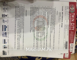 MND(Motor Neuron Disease)