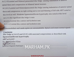 Pectoral Strain - Signs You Are Suffering From It! - By Dr. Akhlaq Ahmed