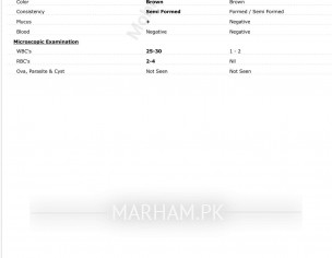 Patient Of Ulcerative Colitis 