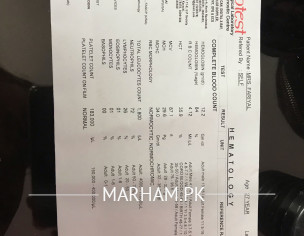 Fever,nausea,headache,bodyache,weakness