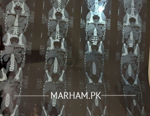 CT Scan?
