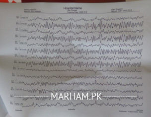 EEG Test Please Study My EEG Test