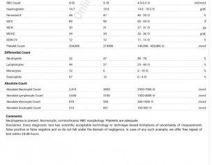 Weakness, Dizziness, Unable To Concentrate, CBC