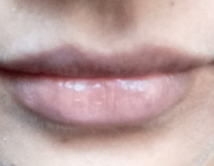 Lips Problem