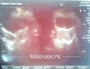 Baby Conceiving Prob