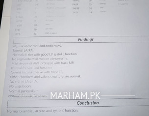 Often Fast Heart Beat