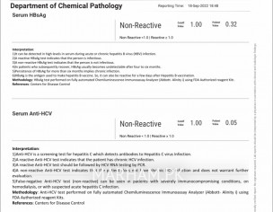 Hiv Check My Reports 