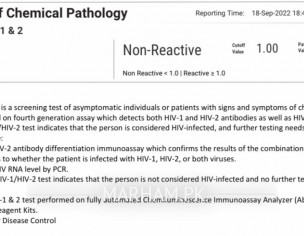 Hiv Check My Reports 