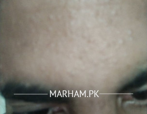 Discussing Skin Related Issue