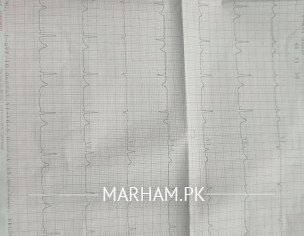 ECG Report