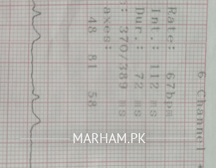 ECG Report
