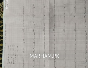 Ecg Report