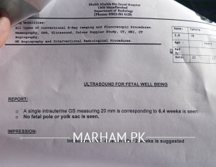 Miscarriged Again And Again