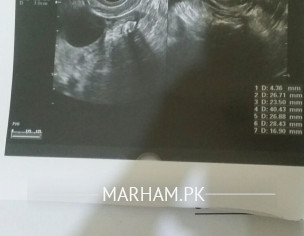 Report Is Fine Or Not?