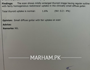 Thyroid Issue And High Bp