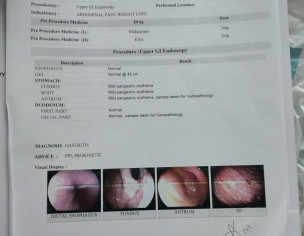 Indigestion And Constipation