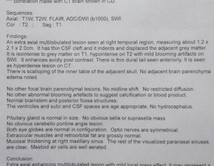  Meningioma Or Cavernoma
