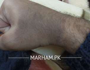 Skin Get Slightly Black