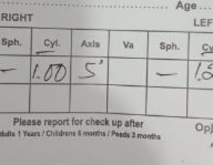 Diplopia (Double Vision)