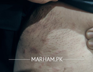 What Is This Skin Issue