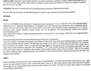MRI Report