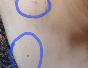 Something Like Lumps