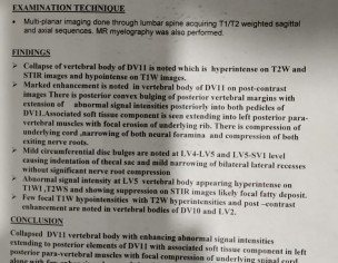 Paraparesis (may Be)