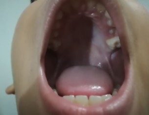Teeth Problem