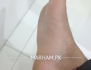 Foot Problem