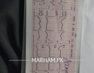 Please Check Lab Report Is Ok