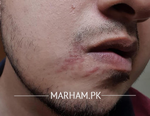 Picture Attached - Skin Condition