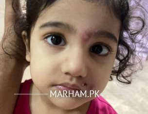 Abnormal Things On My Daugter Face 