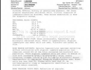 Lymphoma Diagnosed 