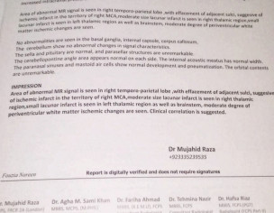 Brain And Paralysis Issue