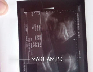 Asking To Radiologist