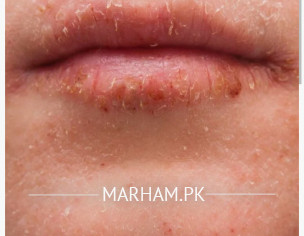 Small Tiny Bimps Full Face