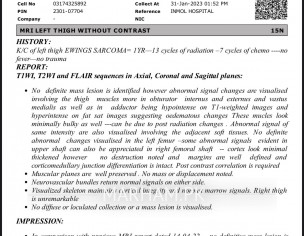 Swelling After Radiation Therapy