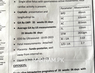 Liquor Level Is High