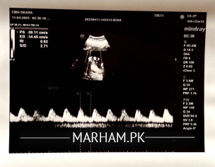 Liquor Level Is High