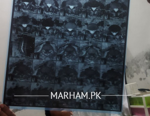 Backbone Have Some Space