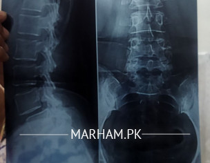 Backbone Have Some Space