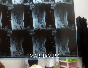 Backbone Have Some Space