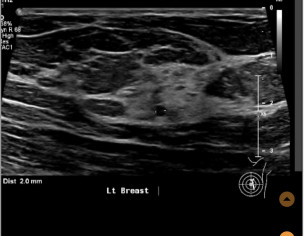 Inflammation? Cancer?