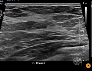 Inflammation? Cancer?